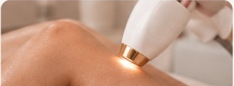 Procedimento de depilação a laser